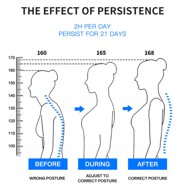 AlignProâ„¢ - Support and Comfort Posture Corrector for Your Everyday Life