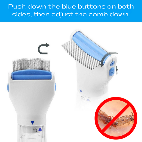 LiceBuster™ - Electric Comb for Eliminating Lice