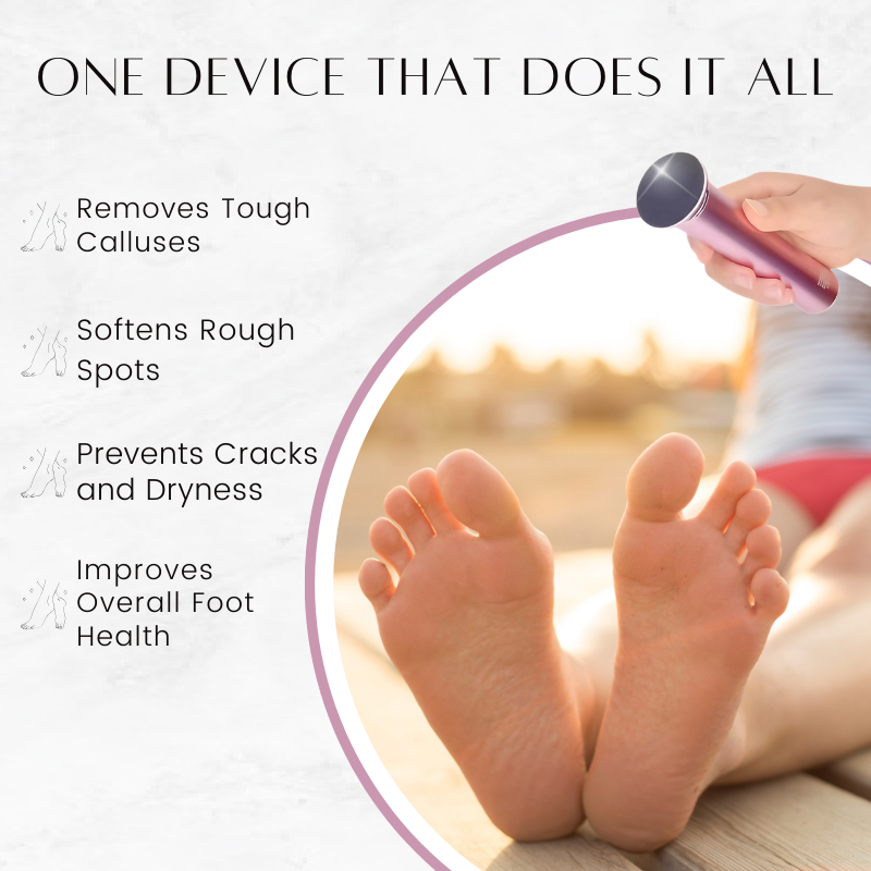 SilkSole™ Effortless Callus Removal at Home