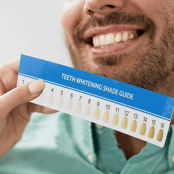 Before & After shade guide